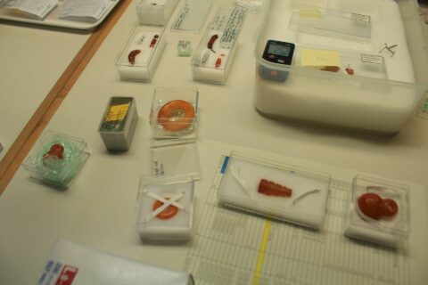 The workspace with amber objects from Heuneburg and Bettelbühl. in the rooms of the Landesdenkmalamt in Esslingen the amber objects are ready for viewing.